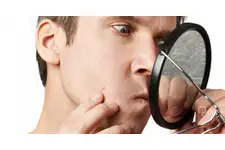 Yüzde Kıl Dönmesi Belirtileri ve Tedavisi